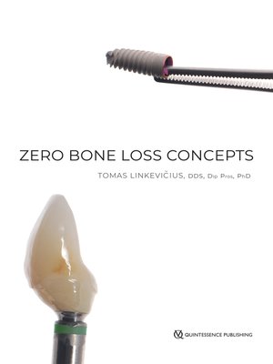 cover image of Zero Bone Loss Concepts